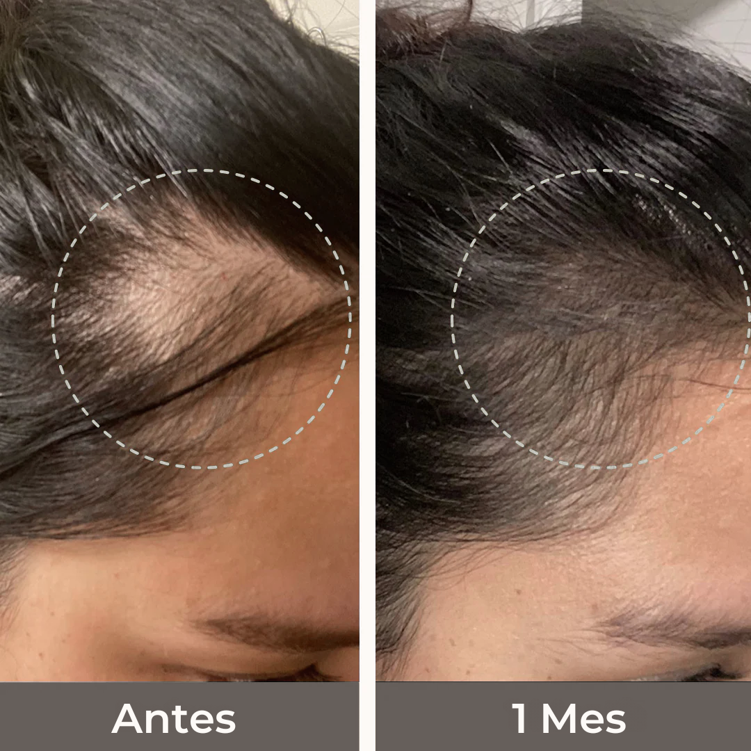 NeuroSatisfy™ Vitaminas para la caída del cabello
