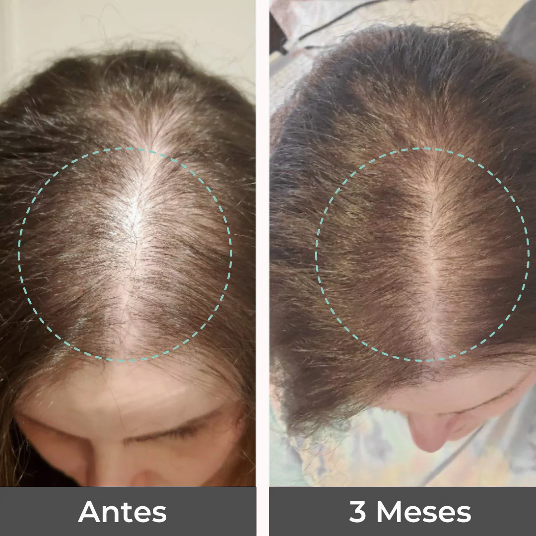 NeuroSatisfy™ Vitaminas para la caída del cabello